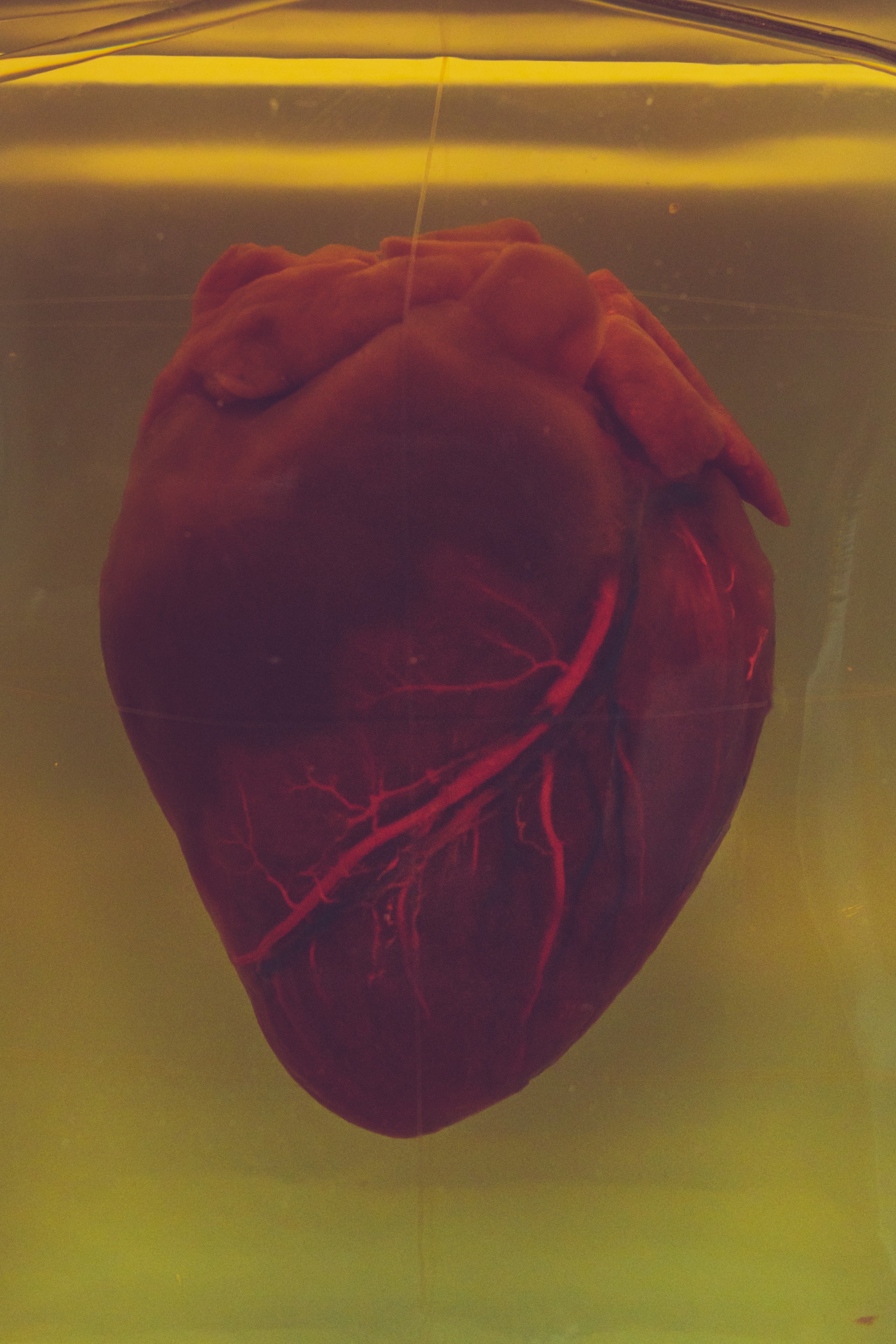 The red color shape of the human heart